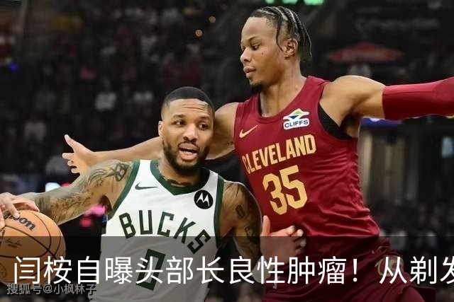 闫桉自曝头部长良性肿瘤！从剃发上手术台到《嫁金钗》播出